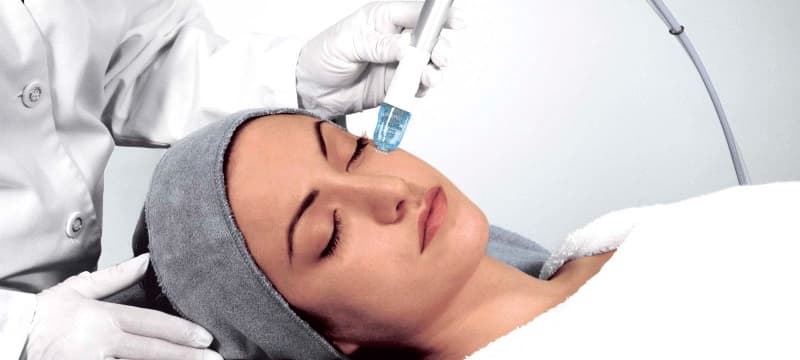 Удаление пигментных пятен на лице лазером в Москве