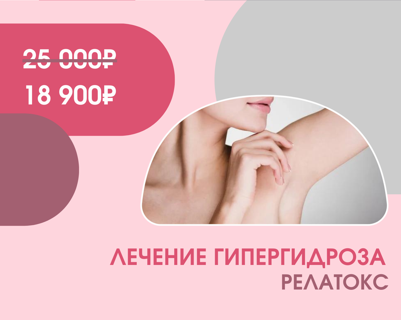 Лечение гипергидроза