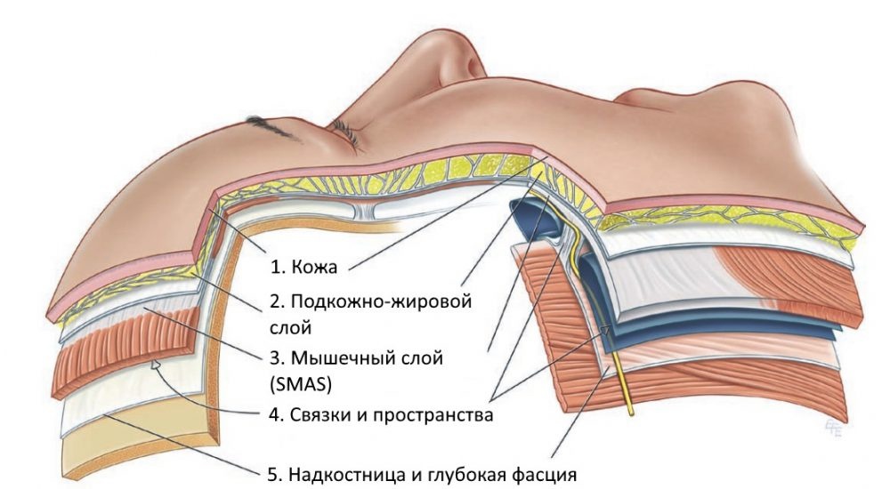 Схематичное расположение СМАС слоя