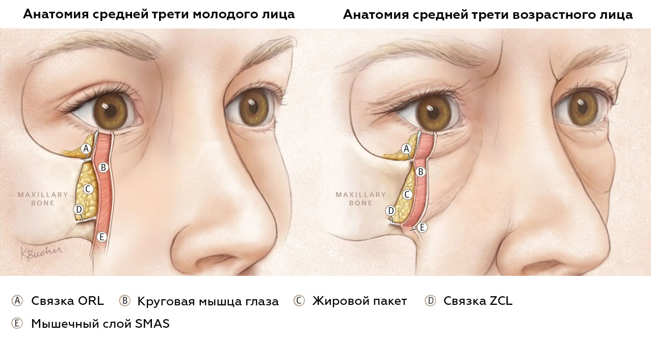 SMAS лифтинг век