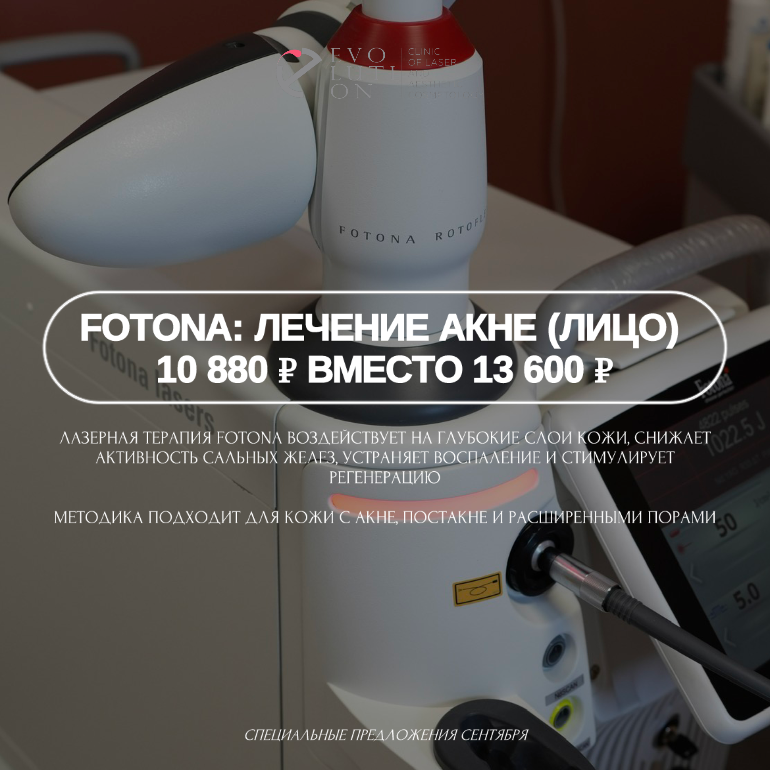 Fotona: лечение акне (лицо) со скидкой