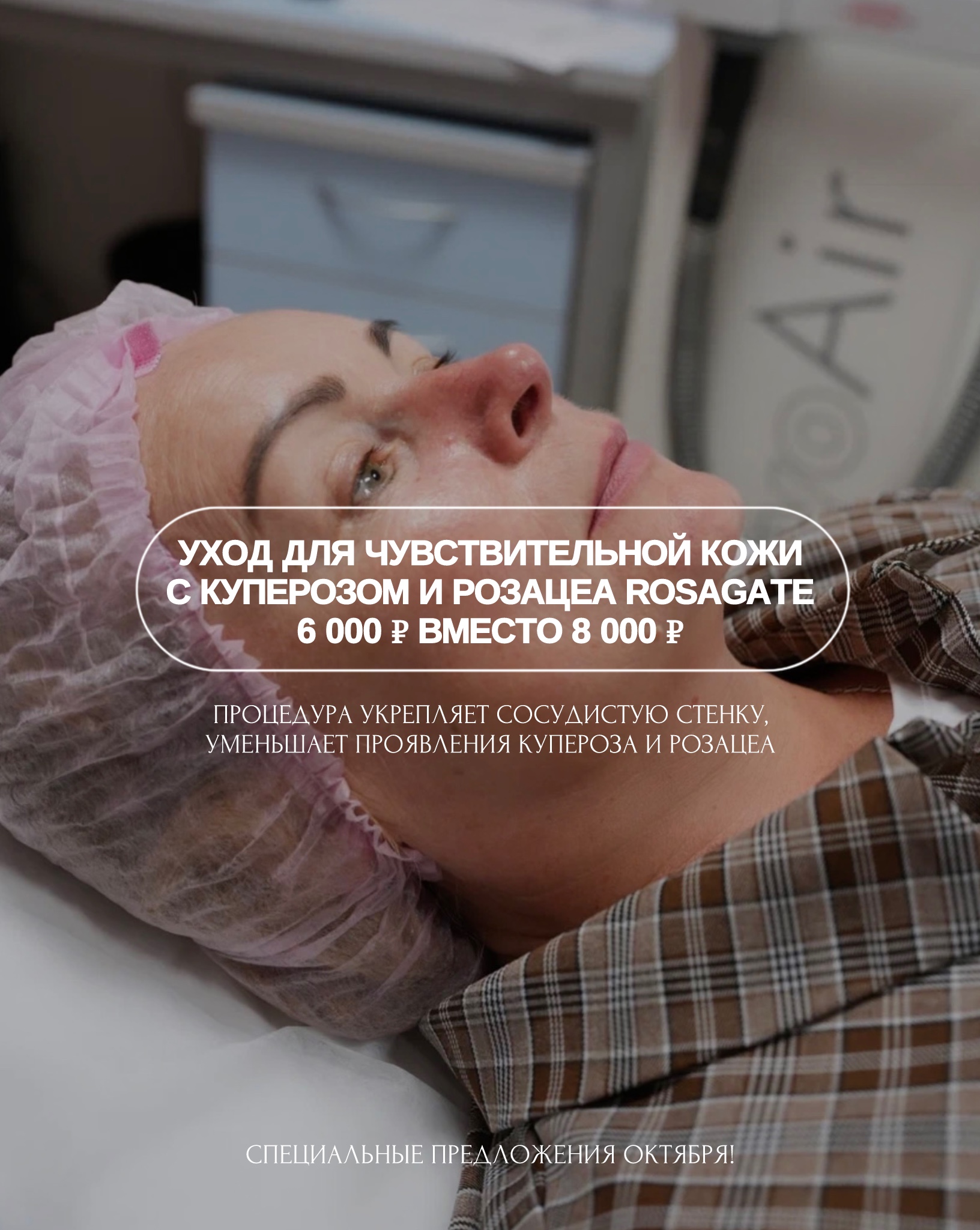 Уход для чувствительной кожи с куперозом и розацеа Rosagate за 6 000 рублей вместо 8 000 рублей