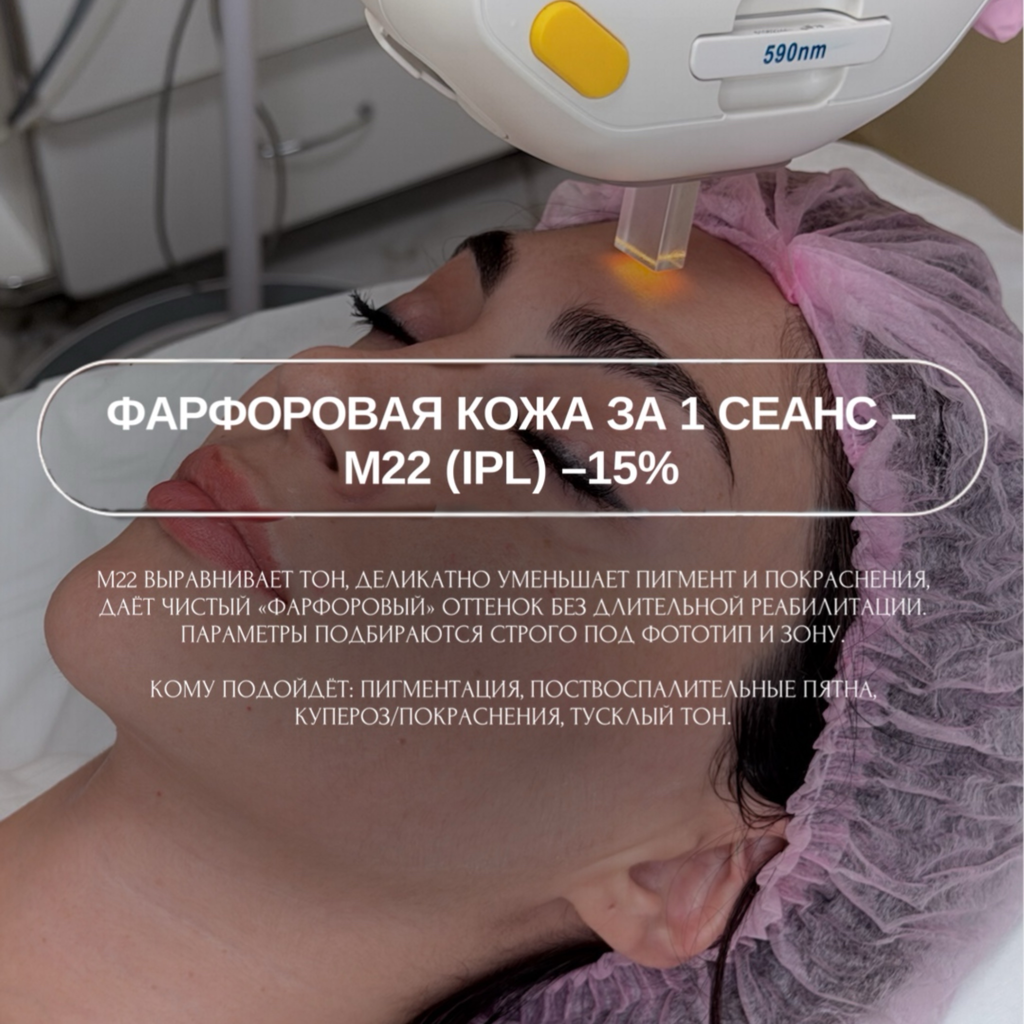 Фарфоровая кожа за 1 сеанс — M22 (IPL) − скидка 15%