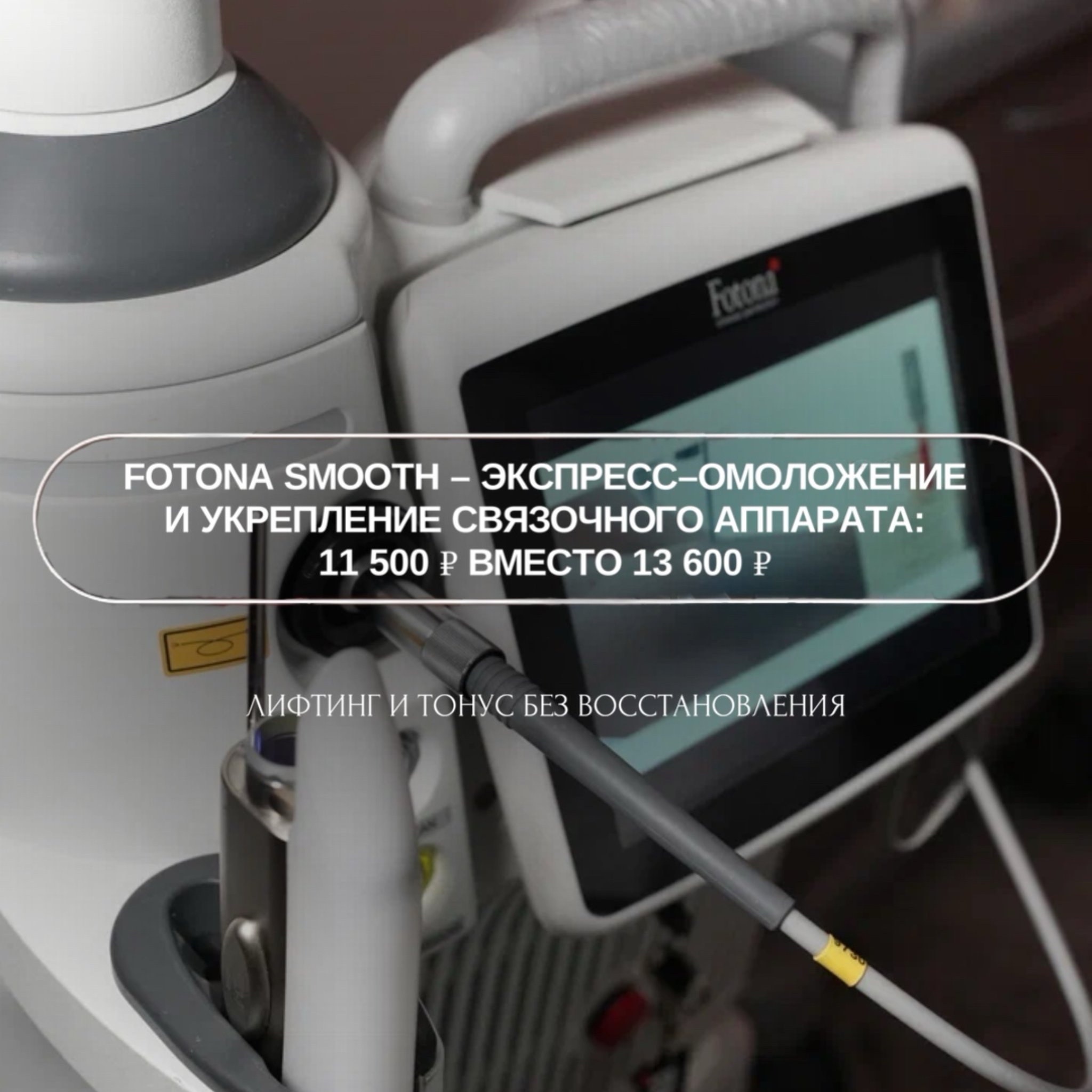 Программа экспресс-омоложения Smooth (Fotona)